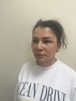 cheklift %E2%80%94 lifting srednej treti licza 11