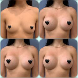 b05cd9e0 77eb 45ff 8145 bb13b8e3ae7a 9ee361bb