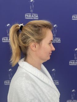 podtyazhka licza i shei 1 dfbf4641