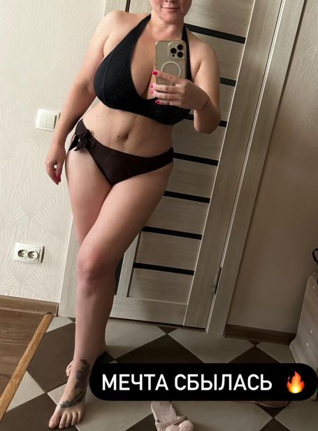 abdominoplastika 111 1 e92264fd